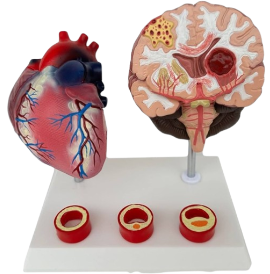 Model Human  Vascular Pathology