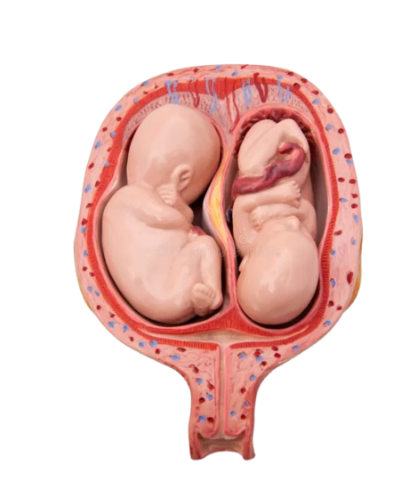 Model Human Child Birth  baby (2-baby)